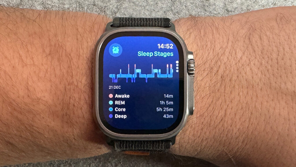 The Apple Watch’s new Vitals app will only work properly if you wear it while sleeping, Apple says